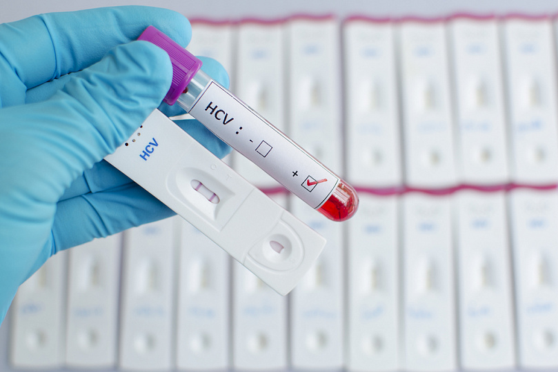 Расшифровка анализ крови при гепатите с расшифровка thumbnail